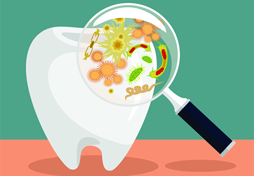 nguyên nhân và triệu chứng của sâu răng