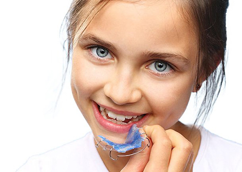 Early orthodontic treatment for children